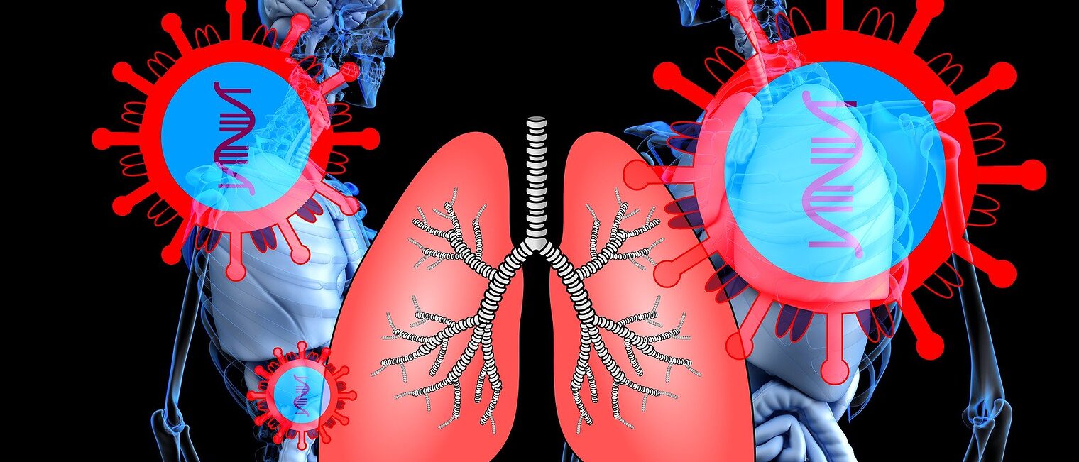 Coronavirus Lunge