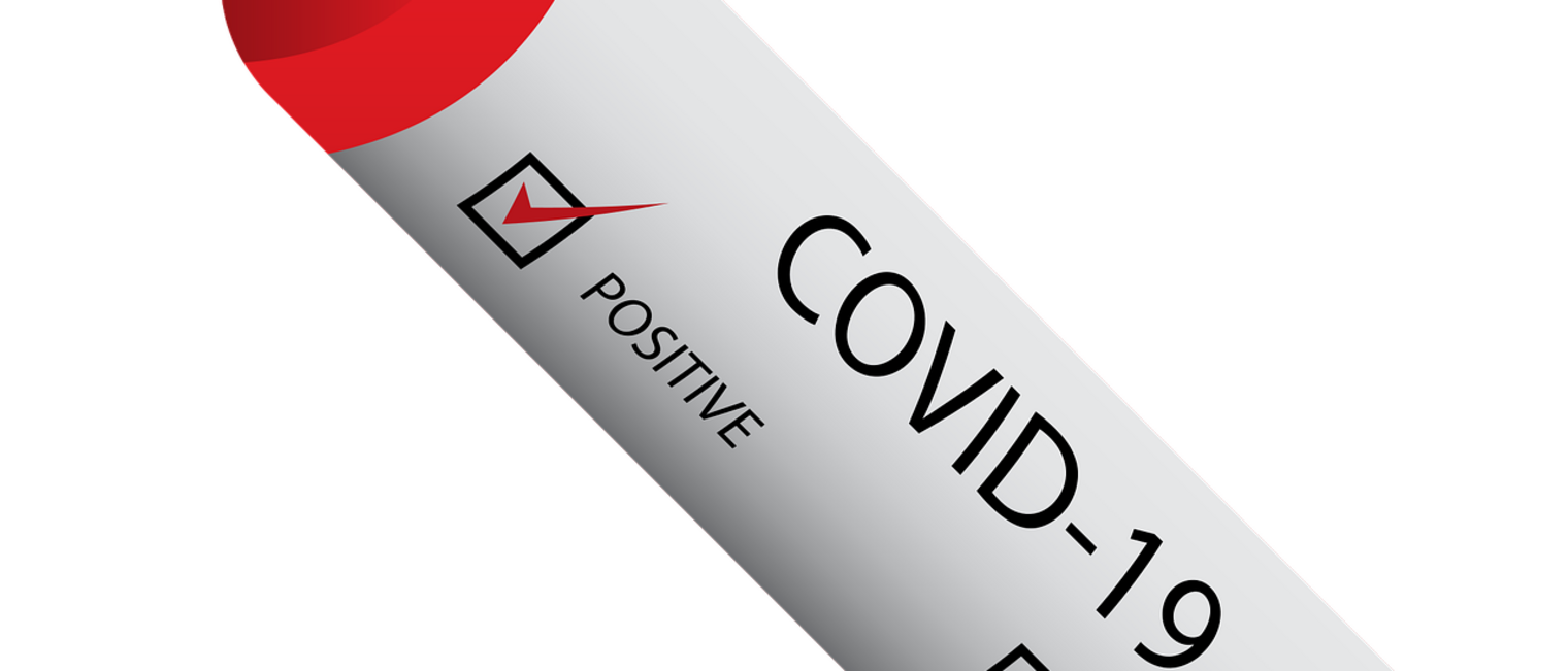 covid-19 Test